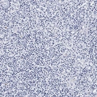 Immunohistochemical staining of human tonsil shows no positivity in non-germinal center cells as expected.