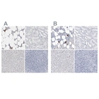 Immunohistochemical staining of human bone marrow, kidney, liver and tonsil using Anti-ITGA2B antibody HPA031169 (A) shows similar protein distribution across tissues to independent antibody HPA031168 (B).