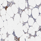 Immunohistochemical staining of human bone marrow shows strong cytoplasmic positivity in hematopoietic cells as expected.