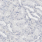 Immunohistochemical staining of human kidney shows no positivity in cells in tubules as expected.