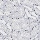 Immunohistochemical staining of human kidney shows no positivity in cells in tubules as expected.