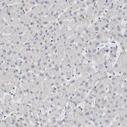 Immunohistochemical staining of human liver shows no positivity in hepatocytes as expected.