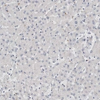 Immunohistochemical staining of human liver shows no positivity in hepatocytes as expected.