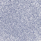 Immunohistochemical staining of human tonsil shows no positivity in non-germinal center cells as expected.