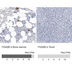 Anti-ITGA2B Antibody