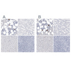 Anti-ITGA2B Antibody