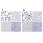 Immunohistochemical staining of human bone marrow, kidney, liver and tonsil using Anti-ITGA2B antibody HPA031170 (A) shows similar protein distribution across tissues to independent antibody HPA031168 (B).