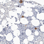 Immunohistochemical staining of human bone marrow shows strong cytoplasmic positivity in hematopoietic cells.