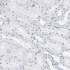 Immunohistochemical staining of human kidney shows no positivity in cells in tubules as expected.