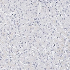 Immunohistochemical staining of human liver shows no positivity in hepatocytes as expected.