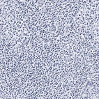 Immunohistochemical staining of human tonsil shows no positivity in non-germinal center cells as expected.