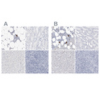 Anti-ITGA2B Antibody