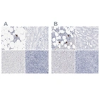 Immunohistochemical staining of human bone marrow, kidney, liver and tonsil using Anti-ITGA2B antibody HPA031171 (A) shows similar protein distribution across tissues to independent antibody HPA031168 (B).