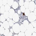 Immunohistochemical staining of human bone marrow shows strong cytoplasmic positivity in hematopoietic cells.