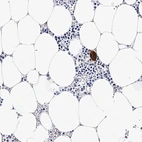 Immunohistochemical staining of human bone marrow shows strong cytoplasmic positivity in hematopoietic cells.