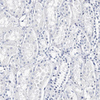 Immunohistochemical staining of human kidney shows no positivity in cells in tubules as expected.