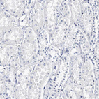 Anti-ITGA2B Antibody