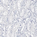 Immunohistochemical staining of human kidney shows no positivity in cells in tubules as expected.