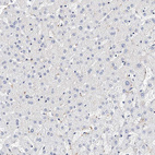 Anti-ITGA2B Antibody