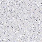 Immunohistochemical staining of human liver shows no positivity in hepatocytes as expected.