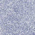 Immunohistochemical staining of human tonsil shows no positivity in non-germinal center cells as expected.