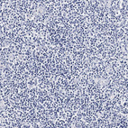 Anti-ITGA2B Antibody