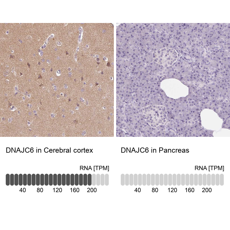 Anti-DNAJC6 Antibody