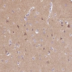 Immunohistochemical staining of human cerebral cortex shows high expression.