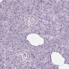 Immunohistochemical staining of human pancreas shows low expression as expected.