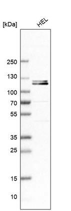 Western blot analysis in human cell line HEL.