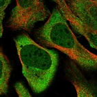 Immunofluorescent staining of human cell line U-2 OS shows localization to nucleoplasm & cytosol.