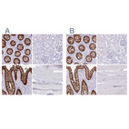 Immunohistochemical staining of human colon, kidney, rectum and skeletal muscle using Anti-LGALS4 antibody HPA031184 (A) shows similar protein distribution across tissues to independent antibody HPA031185 (B).