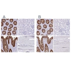 Immunohistochemical staining of human colon, kidney, rectum and skeletal muscle using Anti-LGALS4 antibody HPA031184 (A) shows similar protein distribution across tissues to independent antibody HPA031185 (B).