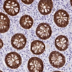 Immunohistochemical staining of human colon shows strong cytoplasmic positivity in glandular cells.