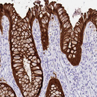 Immunohistochemical staining of human rectum shows strong cytoplasmic positivity in glandular cells.