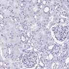 Immunohistochemical staining of human kidney shows no positivity in cells in tubules as expected.