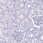Immunohistochemical staining of human kidney shows no positivity in cells in tubules as expected.