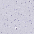 Immunohistochemical staining of human cerebral cortex shows no positivity in neurons as expected.