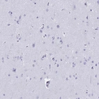 Immunohistochemical staining of human cerebral cortex shows no positivity in neurons as expected.