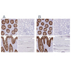 Anti-LGALS4 Antibody