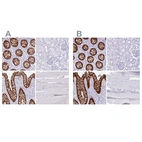 Immunohistochemical staining of human colon, kidney, rectum and skeletal muscle using Anti-LGALS4 antibody HPA031185 (A) shows similar protein distribution across tissues to independent antibody HPA031184 (B).