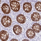 Immunohistochemical staining of human colon shows strong cytoplasmic positivity in glandular cells.