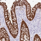 Immunohistochemical staining of human rectum shows strong cytoplasmic positivity in glandular cells.