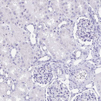 Anti-LGALS4 Antibody