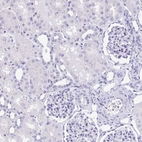 Immunohistochemical staining of human kidney shows no positivity in cells in tubules as expected.
