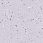 Immunohistochemical staining of human cerebral cortex shows no positivity in neurons as expected.