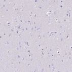 Immunohistochemical staining of human cerebral cortex shows no positivity in neurons as expected.
