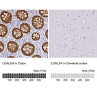 Anti-LGALS4 Antibody