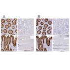 Immunohistochemical staining of human colon, kidney, rectum and skeletal muscle using Anti-LGALS4 antibody HPA031186 (A) shows similar protein distribution across tissues to independent antibody HPA031184 (B).