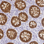 Immunohistochemical staining of human colon shows strong cytoplasmic positivity in glandular cells.